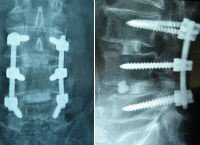 Help with Medical Bills