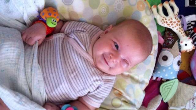 Help baby Josie get a prosthetic eye.
