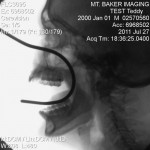 Extreme Side Show Hook Xray Extreme Side Show Hook Xray