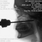 Power drill x-ray Power drill x-ray