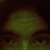 Cerebral_scars_ffff