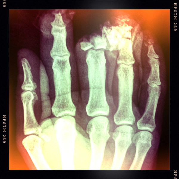 Hip 320356549.699944