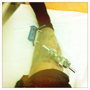 Hip 339539322.430029