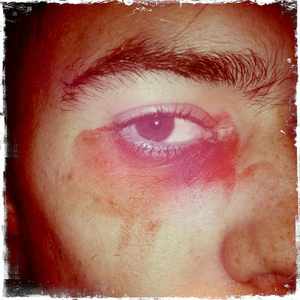 Hip 341534276.102947