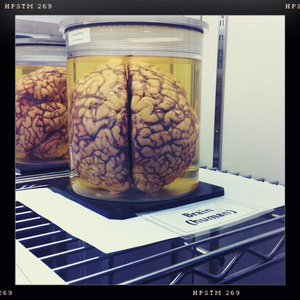 Hip 329601846.585423