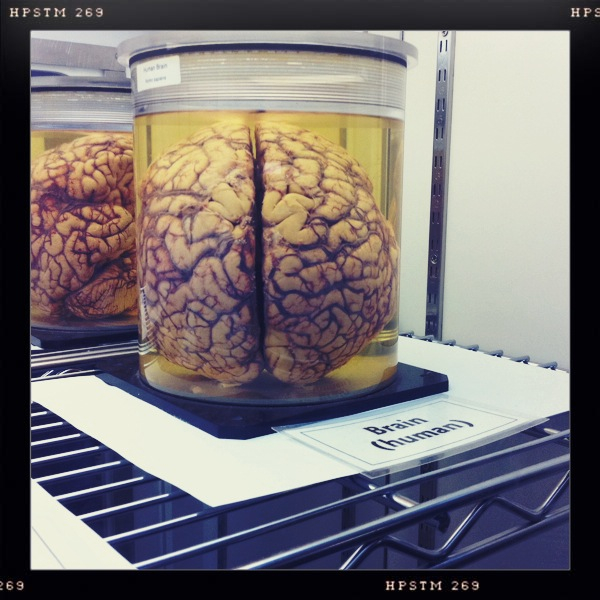 Hip 329601846.585423