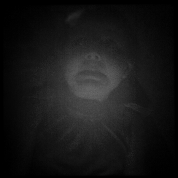 Hip 310267002.200253