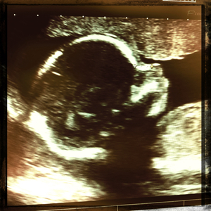 Hip 334689057.854473