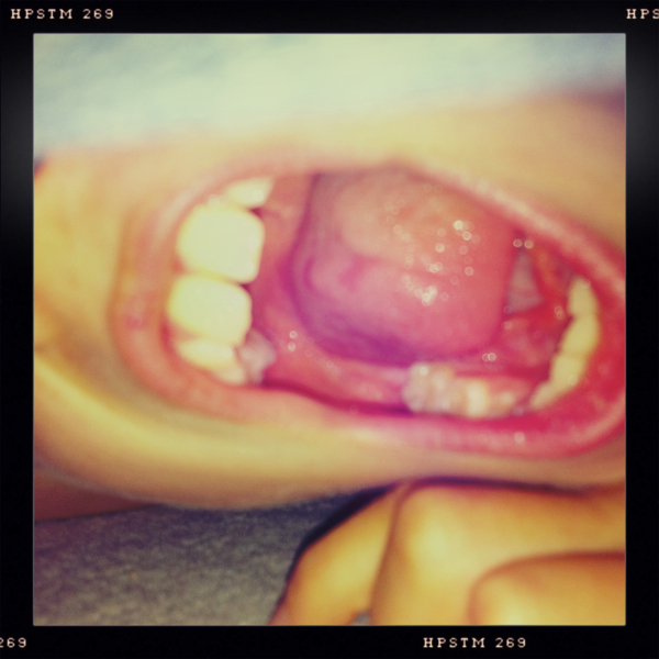 Hip 335393747.810152