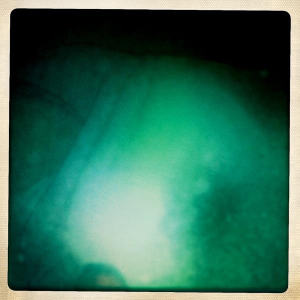 Hip 335744338.105840