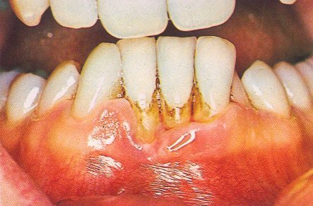 Bad-teeth-774317