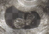 kendra and chase's baby