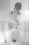 skelton