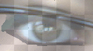 My eye