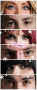 rbd