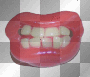 ugly teeth