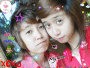kiss