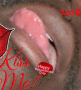 kiss