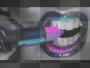 Lips