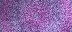 glitter