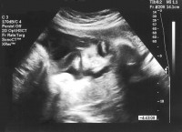 Life Before Birth