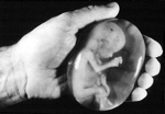 Fetus-in-hand_gs_medium