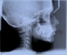 bonefixxer