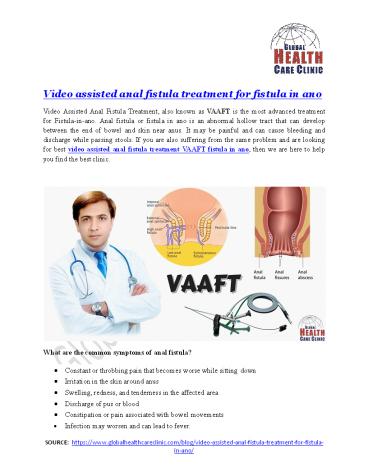 Ppt Video Assisted Anal Fistula Treatment Vaaft Fistula In Ano Powerpoint Presentation Free