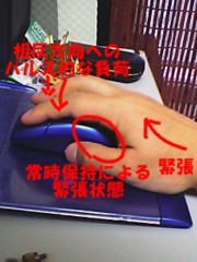 �ޥ����ξ��