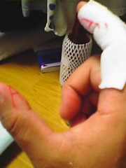 アホな検算