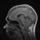 Brain_slice.thumb