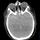 Brainlogo.thumb