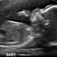 Fb_profile_picture.large