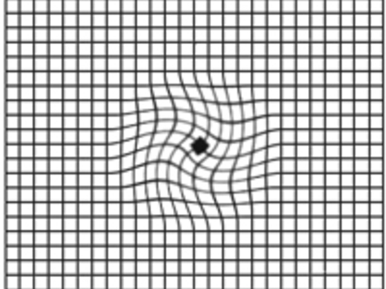 Amslergrid