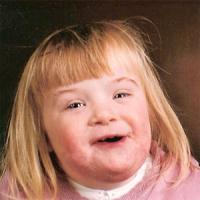Down-Syndrome.jpg