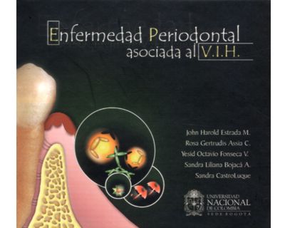 Enfermedad Periodontal asociada al V.I.H. (CD)