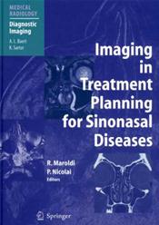 Imaging in Treatment Planning for Sinonasal Diseases