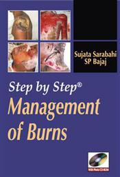 Step by Step Management of Burns. Text with DVD