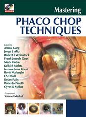 Mastering Phaco Chop Techniques. Text with DVD