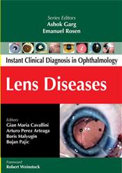 Lens Diseases