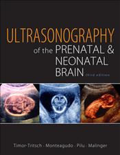 Ultrasonography of the Prenatal Brain