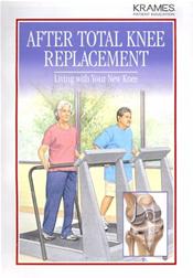 After Total Knee Replacement: Living with Your New Knee