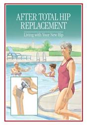 After Total Hip Replacement: Living with Your New Hip Pamphlet