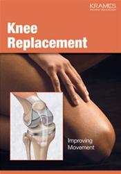 Knee Replacement: Improving Movement Pamphlet