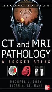 CT and MRI Pathology: A Pocket Atlas