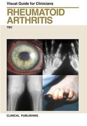 Rheumatoid Arthritis: Visual Guide for Clinicians