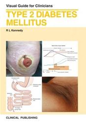Type 2 Diabetes Mellitus: Visual Guide for Clinicians