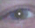 Red Eyes Effect Removal