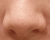 Make a Nose Smaller