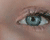 Removing Freckles